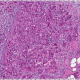 IMMUNOISTOCHIMICA: COSA E'? A COSA SERVE?