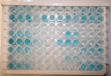 SIEROLOGIA PER MALATTIE INFETTIVE