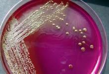 MICROBIOLOGIA
