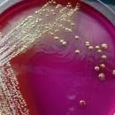 MICROBIOLOGIA