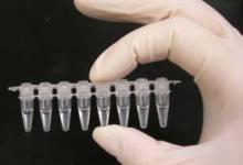 BIOLOGIA MOLECOLARE (PCR)