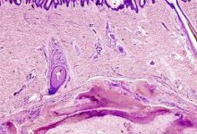 ISTOPATOLOGIA
