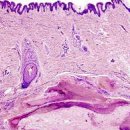 ISTOPATOLOGIA