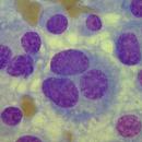 CITOPATOLOGIA