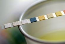 URINE