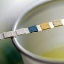 URINE